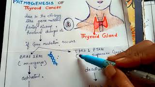 pathogenesis of thyroid cancer NGMedicals [upl. by Intirb]