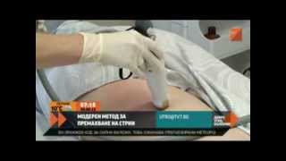 Как се махат стрии  Stretch marks striae removing treatment in Hill Clinic Sofia Bulgaria [upl. by Bills]