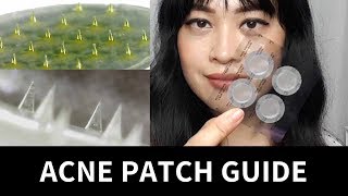 Guide to Acne Patches Hydrocolloid Treatment Microneedle  Lab Muffin Beauty Science [upl. by Jarrett]