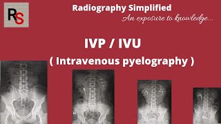 IVP ll Intravenous pyelography ll Intravenous urography ll Radiography simplified ll [upl. by Orvas]