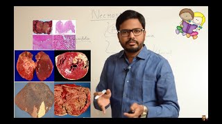 Necrosis amp Types of Necrosis Simplified [upl. by Stoddart]