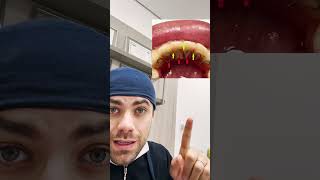 A melhor contenção ortodôntica dentista [upl. by Fabozzi]