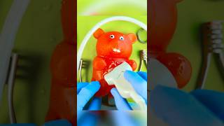 Gummy Surgery Fail😩💔🪦Satisfying Csection flatline DiscountDentist FruitSurgery FoodSurgery [upl. by Aisila]