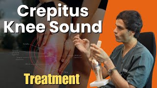 घुटने में काट काट की आवाज़ कैसे करें ठीक  Crepitus Knee Sound Best Treatment [upl. by Yrellih]