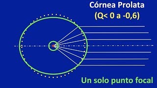 Córnea oblata prolata e hiperprolata Centro de Oftalmología Bonafonte Barcelona [upl. by Philippa]