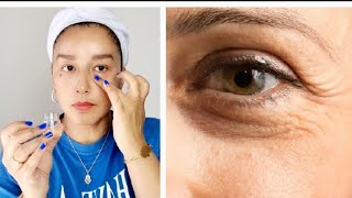 Como eliminar las arrugas debajo de los ojos  Remedio para las arrugas en el contorno de los ojos [upl. by Brande]