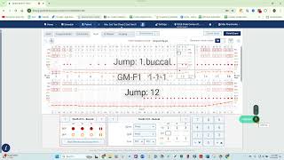 Voice Enabled Perio Charting amp PHI Reporting for Dentrix Ascend with Denti AI Voice [upl. by Rehpotirhc]