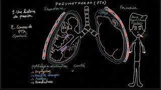 Pneumothorax  Docteur Synapse [upl. by Cawley]