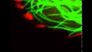 Microtubules poking focal adhesions [upl. by Eniron]