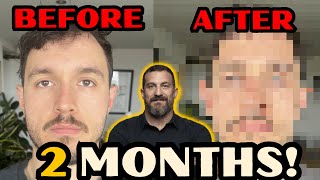 I tried Andrew Hubermans jaw training for 2 MONTHS [upl. by Notxap940]