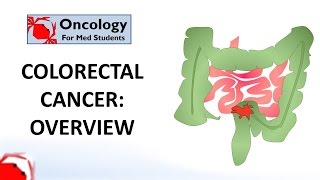 Colorectal Cancer An overview [upl. by Geirk]