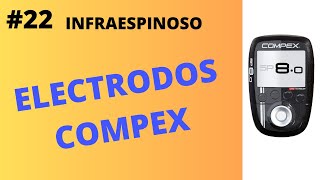 ⭕22 COMPEX en INFRAESPINOSO  ¿Cómo se ponen los electrodos Coloca asi los parches del estimulador [upl. by Llehsam]