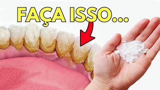 O Melhor Remédio Caseiro para o Tártaro Placa Dentária [upl. by Mortie657]