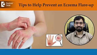 What Causes Eczema to Flare Up  How to Treat amp Get Rid of EczemaDrRajdeep Mysore Doctors Circle [upl. by Eelarol52]