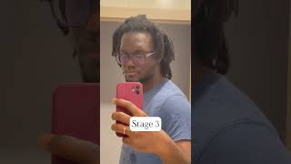 3 stages of Freeform dreads 25 years locjourney [upl. by Nessaj]