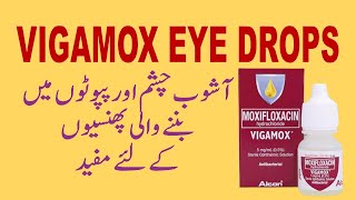 Vigamox Eye Drops uses and side effects in urdu  Vigamox Eye Drops for sty [upl. by Jennilee]