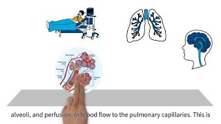 MedEd capnography byte 4 Ventilation perfusion mismatching [upl. by Lleddaw]