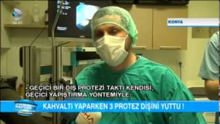 KAHVALTI YAPARKEN 3 PROTEZ DİŞİNİ YUTTU [upl. by Tolkan]