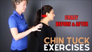 Chin Tuck Exercise  Before and After text neck [upl. by Airehc]