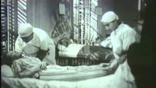 Naples Typhus outbreak 1944 Archive film 92122 [upl. by Fabien27]