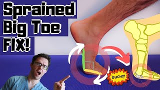 BEST Sprained Big Toe Joint Treatment Turf Toe Treatment amp Exercises [upl. by Eladnwahs522]