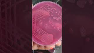 Macconkey agar  culture media  tjbiologist  biology  science  media streaking  medical [upl. by Annovoj]