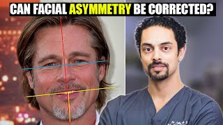 Can Facial Asymmetry Be Corrected  Dr Julian De Silvas Frequently Asked Questions [upl. by Mikol357]