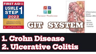 IBD Crohn Disease and Ulcerative Colitis part 2 from first aid step 1USMLEUrduHindi [upl. by Valerian349]