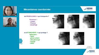 Replay Webinaire  Prise en charge des troubles de la déglutition en cas de maladies neurologiques [upl. by Yekram]