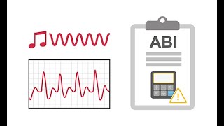 Interpreting ankle brachial index ABI waveforms [upl. by Munster]