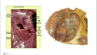 TALLER DE ANATOMÍA CORAZÓN CONFIGURACIÓN INTERNA [upl. by Nnaes819]