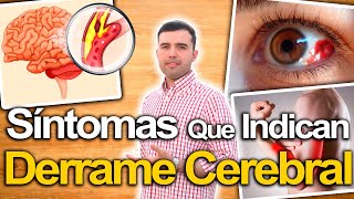 Ojo Con Estos Síntomas  Síntomas De Derrame Cerebral Y Cómo Prevenirlo Naturalmente [upl. by Rojas]