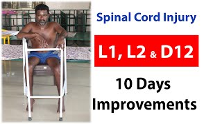 Spinal Cord Injury L1 L2 amp T12  10 Days Improvements  spine spinalcordinjury spineinjury [upl. by Grissom]