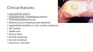 LeprosyHansens disease Pathogenesis Clinical features and treatment l USMLE [upl. by Manvel474]