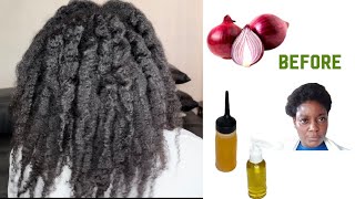 How To Make Onion Hair Growth Oil For Massive Hair Growth Kids’ Friendly Use 3 X A Week 4C Hair [upl. by Wailoo]