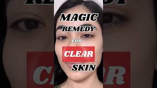 Best Face Toner  For Clear Skin 💁🏻‍♀️ Lavina Ramnani ✨youtubeshorts trending viralshorts [upl. by Cheffetz]