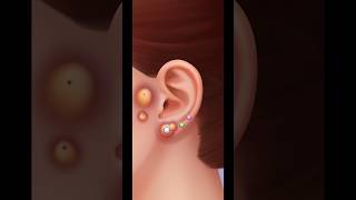 ASMR Ear Cleaning ✨✨ asmr gaming asmrcleaning [upl. by Annaer267]