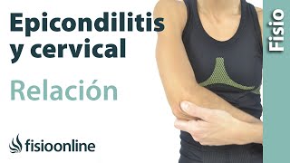 Epicondilitis y su relación con la zona cervical o vértebras cervicales [upl. by Rennoc]