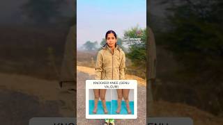 3 exercises for locked knee running kneepain knee lockedknee army shorts runner fitness yt [upl. by Evatsug]