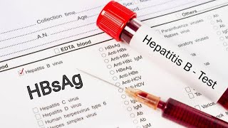 Hepatitis B Rapid Test  কিভাবে হেপাটাইটিসবি ভাইরাস পরীক্ষা করা হয়  HBsAg Test [upl. by Lole]