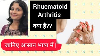 Rheumatoid Arthritis  Easy explanation of RA Treatment  Homeopathy for Rheumatoid Arthritis [upl. by Purpura]