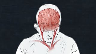 Here’s what we know about COVID19’s impact on the brain [upl. by Novla861]