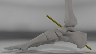 Over Pronation amp Supination Motion Biomechanics of the Subtalar Joint Explained [upl. by Anes]