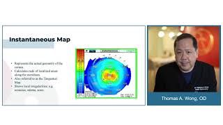 What is Adaptive Optics amp Integrated Wavefront Aberrometry  Thomas Wong OD Presentation [upl. by Proud650]