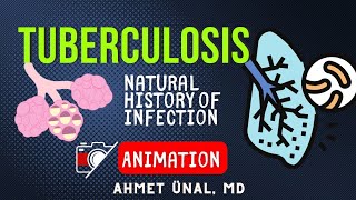 TUBERCULOSIS PATHOPHYSIOLOGY  ANIMATION [upl. by Jackie]