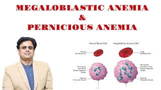 Megaloblastic Anemia amp Pernicious Anemia [upl. by Akital]