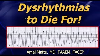 Dysrhythmias workshop [upl. by Knuth]