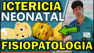 ICTERICIA NEONATAL FISIOPATOLOGÍA  GuiaMed [upl. by Eiduj720]