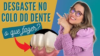 Desgaste no colo do dentes Adornare Odontologia em Santos [upl. by Ecnadnac]