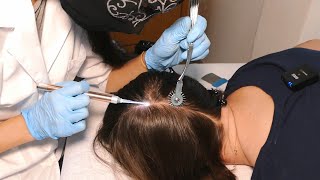 ASMR Scalp Check amp Hairline Exam with Sensory Tests Real Person [upl. by Leia389]